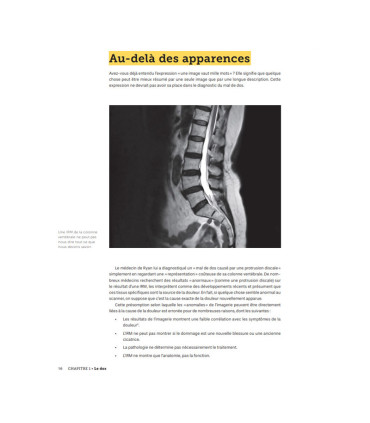 Rebuilding Milo - Le guide ultime de l'haltérophile pour soulager ses blessures